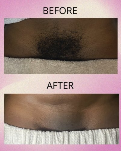 Body waxing before and after results